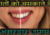 दातों के पीलेपन को करें दूर – Read Teeth Whitening Tips In Hindi teeth whitening tips in hindi