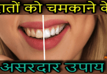 दातों के पीलेपन को करें दूर – Read Teeth Whitening Tips In Hindi teeth whitening tips in hindi