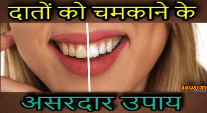 teeth whitening tips in hindi