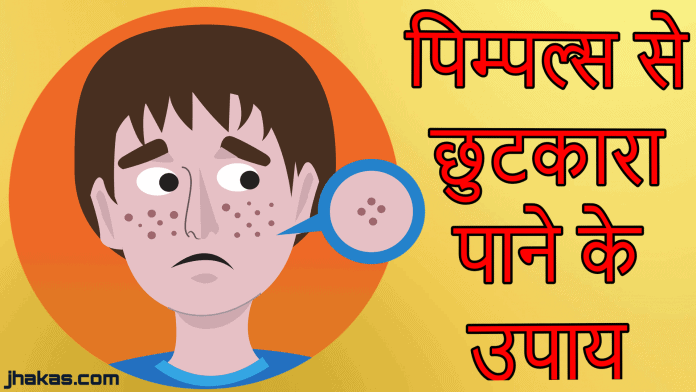 tips for pimple free skin in hindi